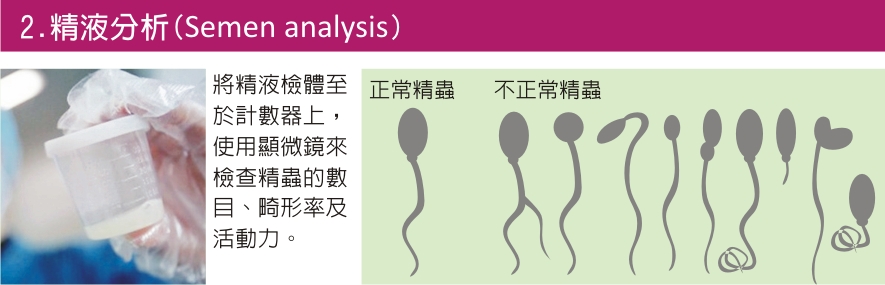 精液分析(Semen analysis)